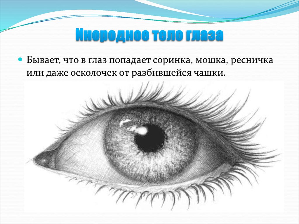 Как вытащить инородное тело из глаза: Инородное тело в глазу. Помощь при попадании и удаление инородного тела из глаза