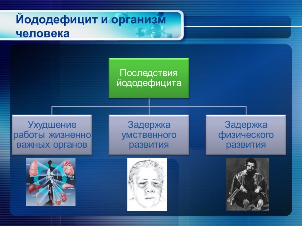 Недостаток йода в организме симптомы у детей: Дефицит йода у детей. Клинические состояния. Эффективность терапии препаратами йода.