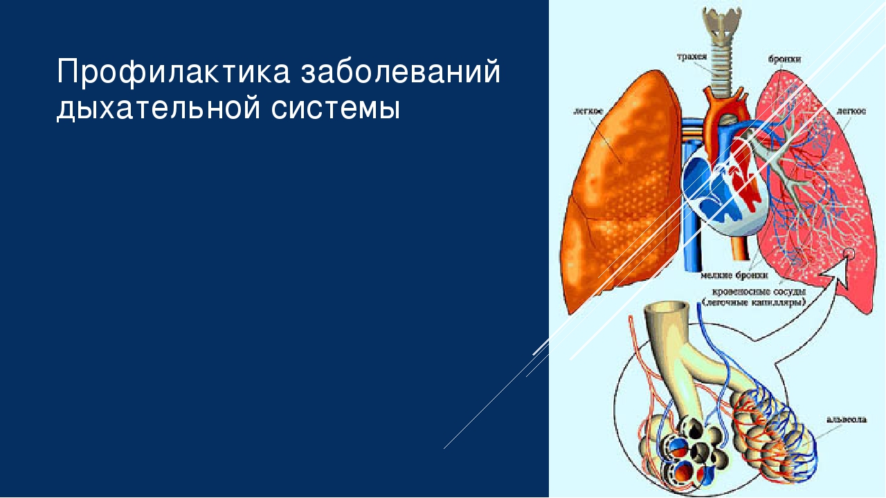 Профилактика заболеваний органов дыхания презентация: Профилактика заболеваний органов дыхания - презентация онлайн