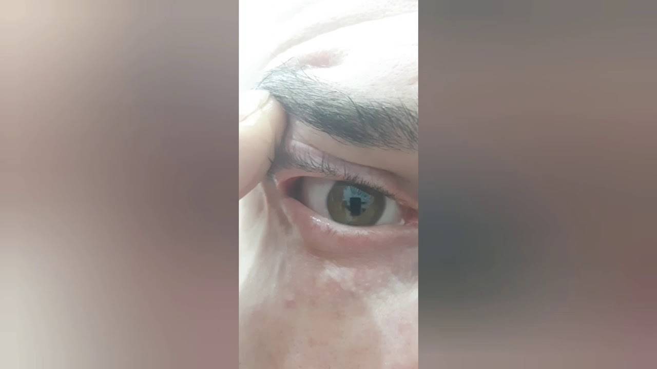 Как из глаза вытащить инородное тело: Как быстро избавиться от соринки в газу
