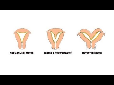 Как выглядят при беременности половые губы: Изменения в организме женщины при беременности