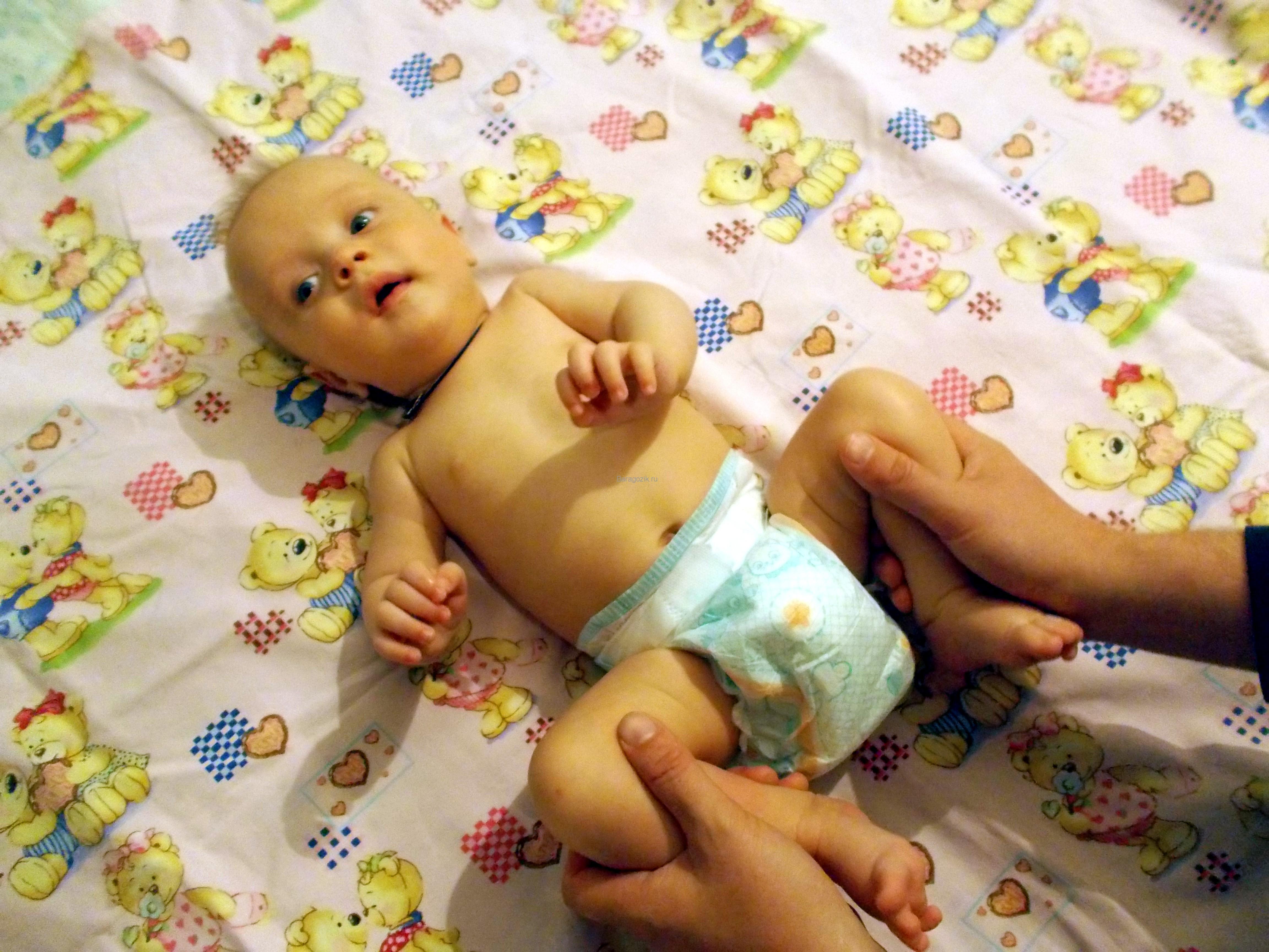 Гипотонус у грудничка форум: Гипотонус у ребенка в 2 года. Такое может быть?