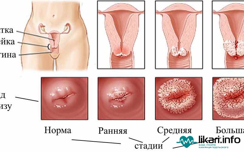 Как выглядят при беременности половые губы: Изменения в организме женщины при беременности