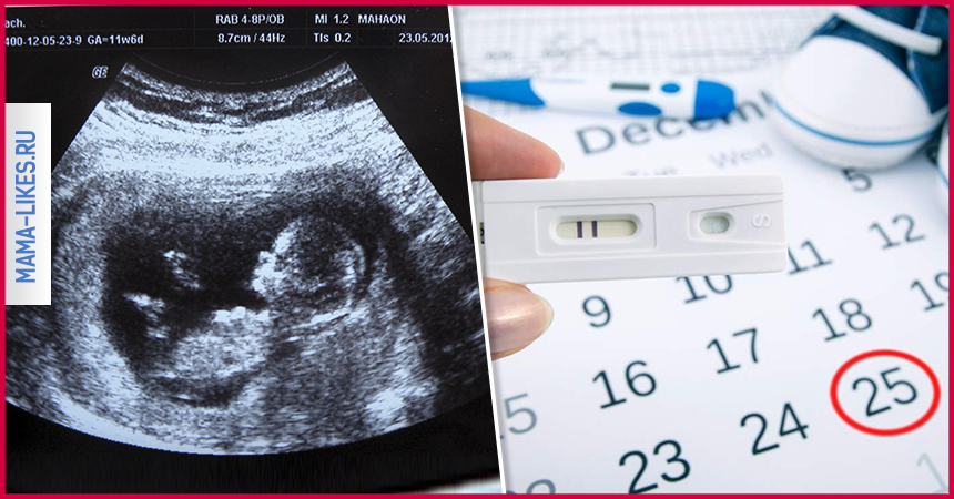 По узи определить дату родов по: Беременность по менструации и ультразвуковая биометрия