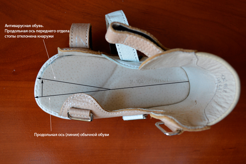 Супинатор в детской обуви что это: Супинатор в обуви - что это такое? Функции и виды супинаторов. Как выбрать обувь с ним? Как борется с плоскостопием?