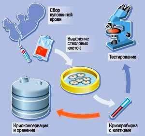 Зачем собирать пуповинную кровь: зачем и как. Беременность и роды – Зачем и как собирать пуповинную кровь новорожденного?