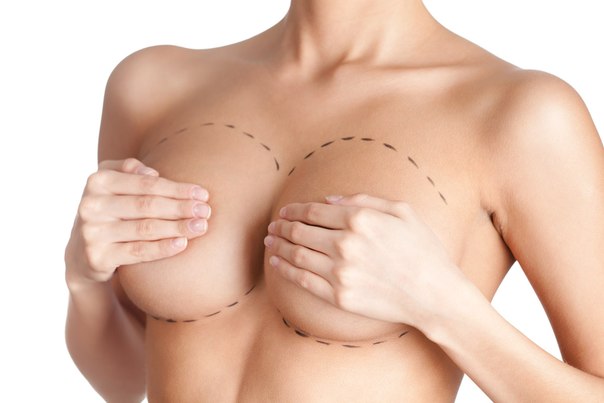 Плюсы и минусы увеличения груди: Плюсы и минусы увеличения груди: только реальные факты